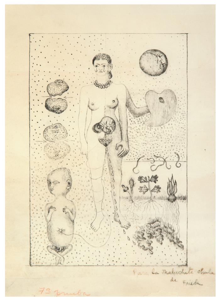 The Miscarriage (Frida and the Miscarriage)